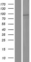 TBC1D12 Protein - Western validation with an anti-DDK antibody * L: Control HEK293 lysate R: Over-expression lysate