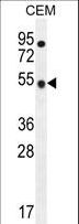 TBC1D13 Antibody - TBC1D13 Antibody western blot of CEM cell line lysates (35 ug/lane). The TBC1D13 antibody detected the TBC1D13 protein (arrow).