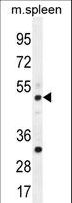 TBC1D13 Antibody - TBC1D13 Antibody western blot of mouse spleen tissue lysates (35 ug/lane). The TBC1D13 antibody detected the TBC1D13 protein (arrow).