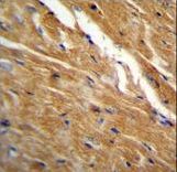 TBC1D13 Antibody - TBC1D13 Antibody immunohistochemistry of formalin-fixed and paraffin-embedded mouse heart tissue followed by peroxidase-conjugated secondary antibody and DAB staining.