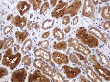 TBC1D13 Antibody - IHC of paraffin-embedded Human Kidney tissue using anti-TBC1D13 mouse monoclonal antibody.