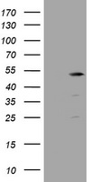 TBC1D13 Antibody - HEK293T cells were transfected with the pCMV6-ENTRY control (Left lane) or pCMV6-ENTRY TBC1D13 (Right lane) cDNA for 48 hrs and lysed. Equivalent amounts of cell lysates (5 ug per lane) were separated by SDS-PAGE and immunoblotted with anti-TBC1D13.