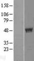 TBC1D13 Protein - Western validation with an anti-DDK antibody * L: Control HEK293 lysate R: Over-expression lysate