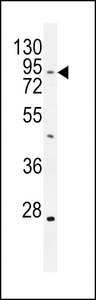 TBC1D14 Antibody - TBC14 Antibody western blot of mouse heart tissue lysates (35 ug/lane). The TBC14 antibody detected the TBC14 protein (arrow).