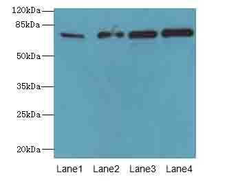 TBC1D14 Antibody - Western blot. All lanes: TBC1D14 antibody at 4 ug/ml. Lane 1: K562 whole cell lysate. Lane 2: U87 whole cell lysate. Lane 3: A549 whole cell lysate. Lane 4: HepG-2 whole cell lysate. Secondary Goat polyclonal to Rabbit IgG at 1:10000 dilution. Predicted band size: 78 kDa. Observed band size: 78 kDa.