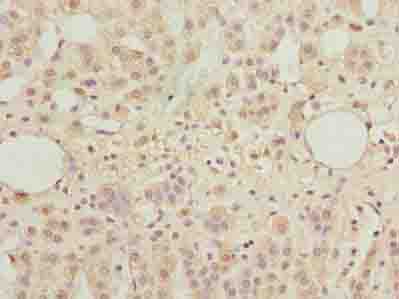 TBC1D14 Antibody - Immunohistochemistry of paraffin-embedded human adrenal gland tissue using antibody at dilution of 1:100.