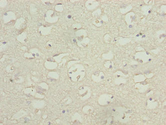 TBC1D14 Antibody - Immunohistochemistry of paraffin-embedded human brain tissue using TBC1D14 Antibody at dilution of 1:100