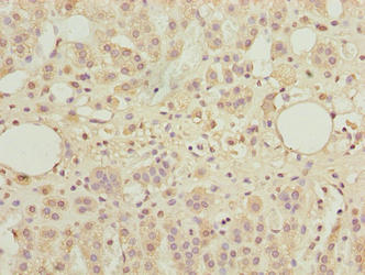 TBC1D14 Antibody - Immunohistochemistry of paraffin-embedded human adrenal gland tissue using TBC1D14 Antibody at dilution of 1:100