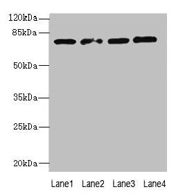 TBC1D14 Antibody - Western blot All lanes: TBC1D14 antibody at 4µg/ml Lane 1: K562 whole cell lysate Lane 2: U87 whole cell lysate Lane 3: A549 whole cell lysate Lane 4: HepG2 whole cell lysate Secondary Goat polyclonal to rabbit IgG at 1/10000 dilution Predicted band size: 79, 48 kDa Observed band size: 79 kDa
