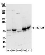 TBC1D15 Antibody - Detection of human and mouse TBC1D15 by western blot. Samples: Whole cell lysate (50 µg) from HeLa, HEK293T, Jurkat, mouse TCMK-1, and mouse NIH 3T3 cells prepared using NETN lysis buffer. Antibodies: Affinity purified rabbit anti-TBC1D15 antibody used for WB at 0.4 µg/ml. Detection: Chemiluminescence with an exposure time of 30 seconds.