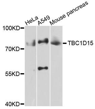 TBC1D15 Antibody - Western blot analysis of extracts of various cell lines, using TBC1D15 antibody at 1:1000 dilution. The secondary antibody used was an HRP Goat Anti-Rabbit IgG (H+L) at 1:10000 dilution. Lysates were loaded 25ug per lane and 3% nonfat dry milk in TBST was used for blocking. An ECL Kit was used for detection and the exposure time was 10s.