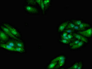 TBC1D15 Antibody - Immunofluorescent analysis of Hepg2 cells at a dilution of 1:100 and Alexa Fluor 488-congugated AffiniPure Goat Anti-Rabbit IgG(H+L)