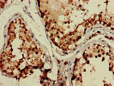 TBC1D15 Antibody - Immunohistochemistry image of paraffin-embedded human testis tissue at a dilution of 1:100