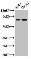 TBC1D15 Antibody - Positive Western Blot detected in A549 whole cell lysate, HepG2 whole cell lysate. All lanes: TBC1D15 antibody at 3 µg/ml Secondary Goat polyclonal to rabbit IgG at 1/50000 dilution. Predicted band size: 80, 78, 79 KDa. Observed band size: 80 KDa