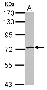 TBC1D15 Antibody - Sample (30 ug of whole cell lysate) A: PC-3 7.5% SDS PAGE TBC1D15 antibody diluted at 1:1000