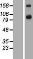 TBC1D16 Protein - Western validation with an anti-DDK antibody * L: Control HEK293 lysate R: Over-expression lysate
