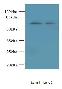 TBC1D19 Antibody - Western blot. All lanes: TBC1D19 antibody at 9 ug/ml. Lane 1: U251 whole cell lysate. Lane 2: A375 whole cell lysate. Secondary antibody: Goat polyclonal to Rabbit IgG at 1:10000 dilution. Predicted band size: 60 kDa. Observed band size: 60 kDa.