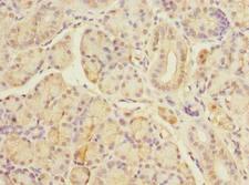 TBC1D19 Antibody - Immunohistochemistry of paraffin-embedded human pancreatic tissue using antibody at dilution of 1:100.