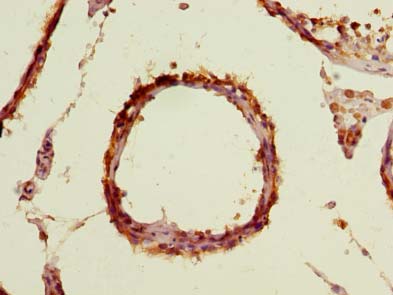 TBC1D19 Antibody - Immunohistochemistry of paraffin-embedded human testis tissue using antibody at dilution of 1:100.