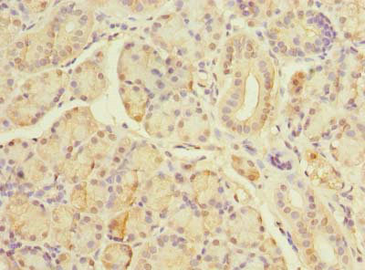 TBC1D19 Antibody - Immunohistochemistry of paraffin-embedded human pancreatic tissue using TBC1D19 Antibody at dilution of 1:100