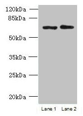 TBC1D19 Antibody - Western blot All lanes: TBC1D19 antibody at 9µg/ml Lane 1: U251 whole cell lysate Lane 2: A375 whole cell lysate Secondary Goat polyclonal to rabbit IgG at 1/10000 dilution Predicted band size: 61, 53 kDa Observed band size: 61 kDa
