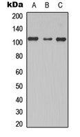 TBC1D2 Antibody - Western blot analysis of TBC1D2 expression in MCF7 (A); NS-1 (B); PC12 (C) whole cell lysates.