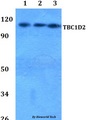 TBC1D2 Antibody - Western blot of TBC1D2 antibody at 1:500 dilution. Lane 1: MCF-7 whole cell lysate. Lane 2: sp2/0 whole cell lysate. Lane 3: PC12 whole cell lysate.