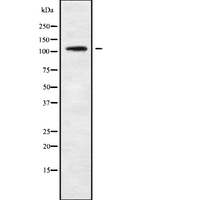 TBC1D2 Antibody - Western blot analysis of TBC1D2 using COLO205 whole cells lysates