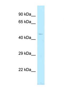 TBC1D20 Antibody - TBC1D20 antibody Western blot of Fetal Heart lysate. Antibody concentration 1 ug/ml.  This image was taken for the unconjugated form of this product. Other forms have not been tested.