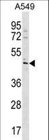 TBC1D20 Antibody - TBC1D20 Antibody western blot of A549 cell line lysates (35 ug/lane). The TBC1D20 antibody detected the TBC1D20 protein (arrow).