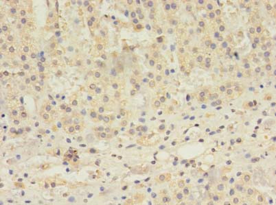 TBC1D20 Antibody - Immunohistochemistry of paraffin-embedded human adrenal gland tissue using antibody at dilution of 1:100.