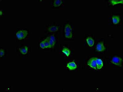 TBC1D20 Antibody - Immunofluorescent analysis of MCF-7 cells using TBC1D20 Antibody at dilution of 1:100 and Alexa Fluor 488-congugated AffiniPure Goat Anti-Rabbit IgG(H+L)