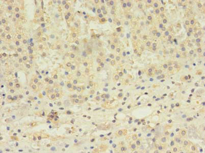 TBC1D20 Antibody - Immunohistochemistry of paraffin-embedded human adrenal gland tissue using TBC1D20 Antibody at dilution of 1:100