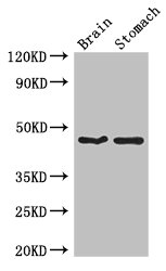 TBC1D20 Antibody - Western Blot Positive WB detected in: Mouse brain tissue, Mouse stomach tissue All lanes: TBC1D20 antibody at 4µg/ml Secondary Goat polyclonal to rabbit IgG at 1/50000 dilution Predicted band size: 46, 20, 49 kDa Observed band size: 46 kDa