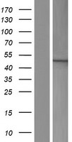 TBC1D20 Protein - Western validation with an anti-DDK antibody * L: Control HEK293 lysate R: Over-expression lysate