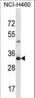 TBC1D21 Antibody - TBC1D21 Antibody western blot of NCI-H460 cell line lysates (35 ug/lane). The TBC1D21 antibody detected the TBC1D21 protein (arrow).