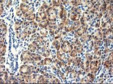 TBC1D21 Antibody - IHC of paraffin-embedded Human pancreas tissue using anti-TBC1D21 mouse monoclonal antibody. (Heat-induced epitope retrieval by 10mM citric buffer, pH6.0, 100C for 10min).