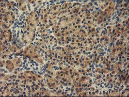 TBC1D21 Antibody - IHC of paraffin-embedded Human pancreas tissue using anti-TBC1D21 mouse monoclonal antibody.