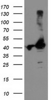 TBC1D21 Antibody - HEK293T cells were transfected with the pCMV6-ENTRY control (Left lane) or pCMV6-ENTRY TBC1D21 (Right lane) cDNA for 48 hrs and lysed. Equivalent amounts of cell lysates (5 ug per lane) were separated by SDS-PAGE and immunoblotted with anti-TBC1D21.