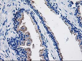 TBC1D21 Antibody - IHC of paraffin-embedded Human prostate tissue using anti-TBC1D21 mouse monoclonal antibody.