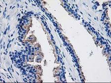 TBC1D21 Antibody - IHC of paraffin-embedded Human prostate tissue using anti-TBC1D21 mouse monoclonal antibody.