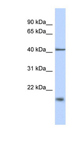 TBC1D21 Antibody - TBC1D21 antibody Western blot of Fetal Brain lysate. This image was taken for the unconjugated form of this product. Other forms have not been tested.
