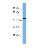 TBC1D22A Antibody - Western blot of Human NCI-H226. TBC1D22A antibody dilution 1.0 ug/ml.  This image was taken for the unconjugated form of this product. Other forms have not been tested.