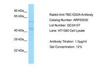 TBC1D22A Antibody -  This image was taken for the unconjugated form of this product. Other forms have not been tested.