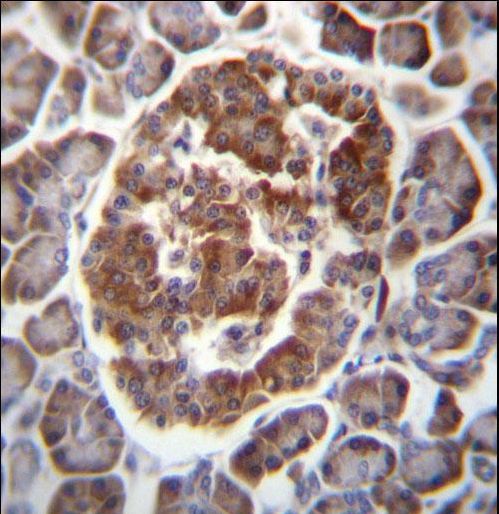 TBC1D22A Antibody - TBC1D22A Antibody immunohistochemistry of formalin-fixed and paraffin-embedded human pancreas tissue followed by peroxidase-conjugated secondary antibody and DAB staining.