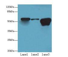 TBC1D22A Antibody - Western blot. All lanes: TBC1D22A antibody at 18 ug/ml. Lane 1: Colo320 whole cell lysate. Lane 2: HepG-2 whole cell lysate. Lane 3: Rat Skeletal muscle tissue. Secondary antibody: Goat polyclonal to Rabbit IgG at 1:10000 dilution. Predicted band size: 59 kDa. Observed band size: 59 kDa.