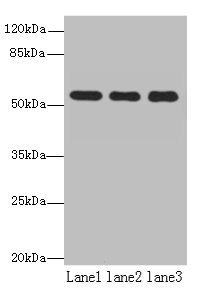 TBC1D22A Antibody - Western blot All lanes: TBC1D22A antibody at 18µg/ml Lane 1: Colo320 whole cell lysate Lane 2: HepG2 whole cell lysate Lane 3: Rat skeletal muscle tissue Secondary Goat polyclonal to rabbit IgG at 1/10000 dilution Predicted band size: 60, 51, 37, 54 kDa Observed band size: 60 kDa