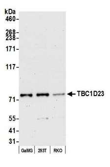 TBC1D23 Antibody - Detection of human TBC1D23 by western blot. Samples: Whole cell lysate (15 µg) from GaMG, HEK293T, and RKO cells prepared using NETN lysis buffer. Antibody: Affinity purified Rabbit anti-TBC1D23 antibody used for WB at 1:1000. Secondary: HRP-conjugated goat anti-rabbit IgG (A120-101P). Chemiluminescence with an exposure time of 75 seconds.