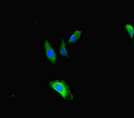 TBC1D24 Antibody - Immunofluorescent analysis of Hela cells diluted at 1:100 and Alexa Fluor 488-congugated AffiniPure Goat Anti-Rabbit IgG(H+L)