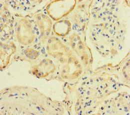 TBC1D24 Antibody - Immunohistochemistry of paraffin-embedded human kidney tissue at dilution of 1:100
